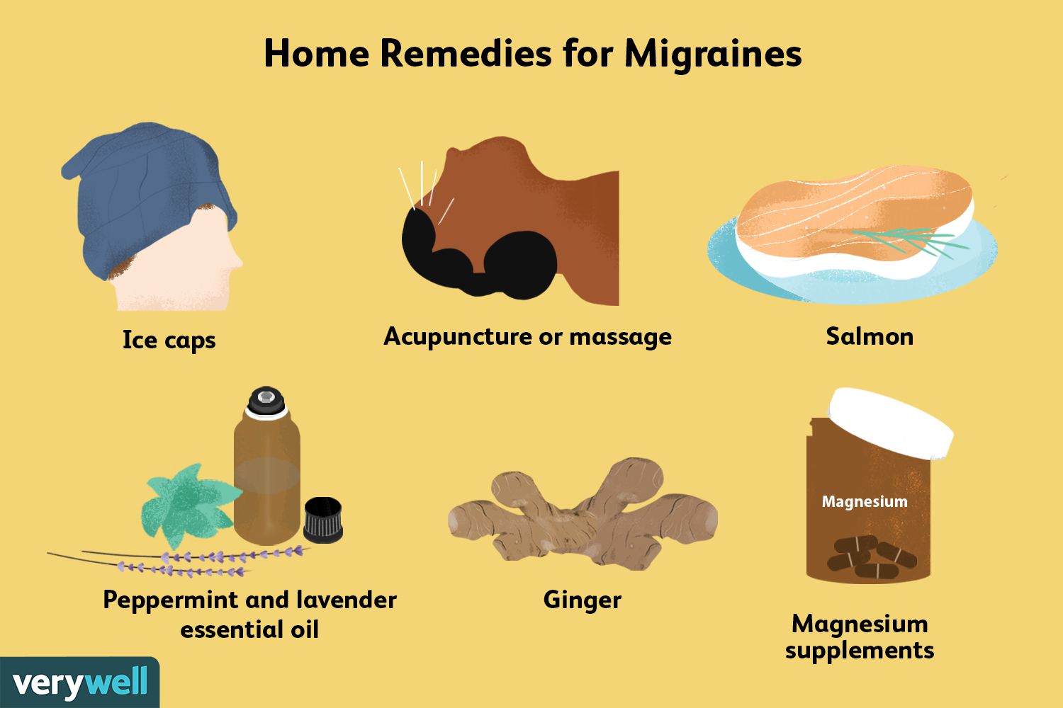 Are there pain relief options for migraines?