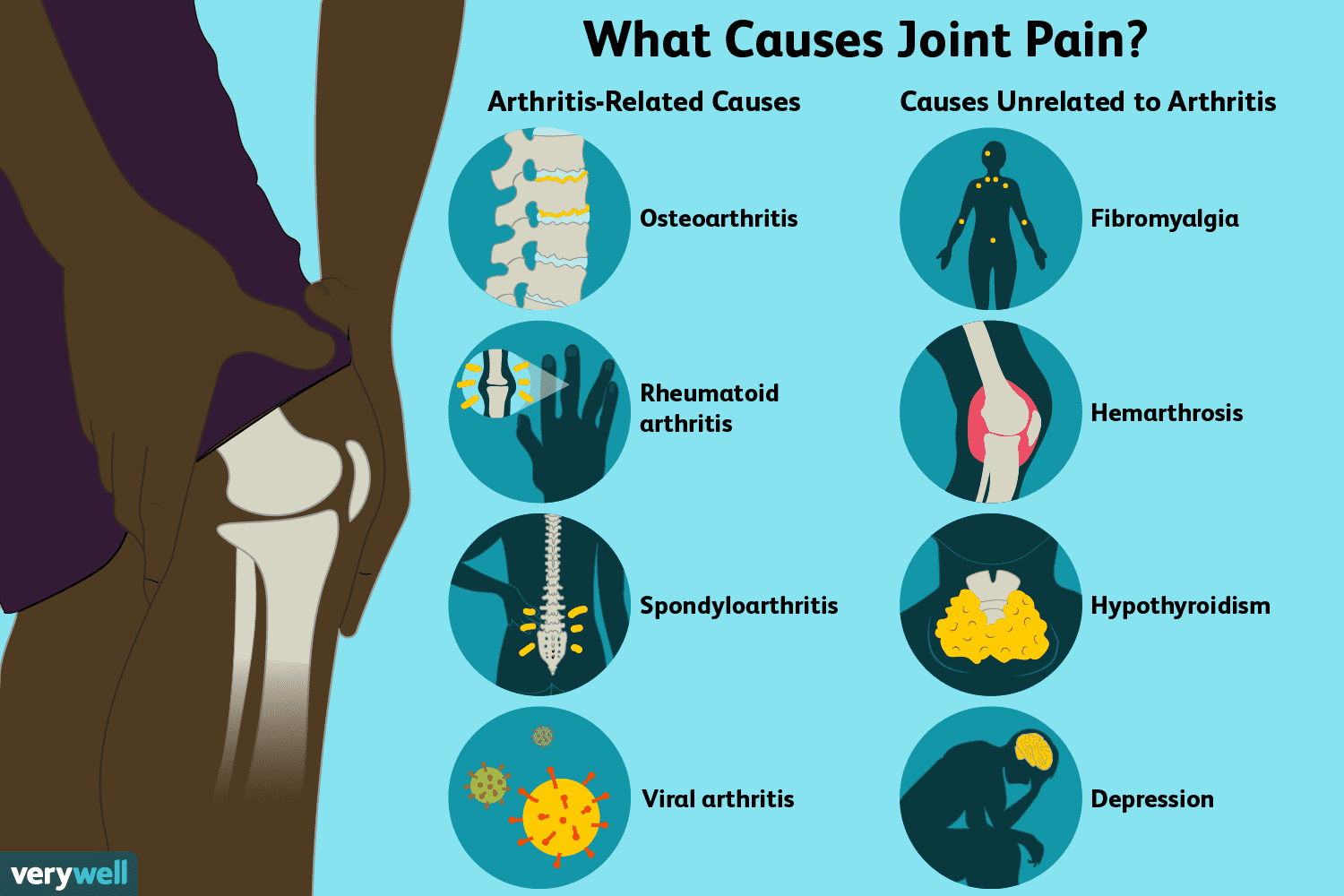 Are there pain relief options for joint pain?