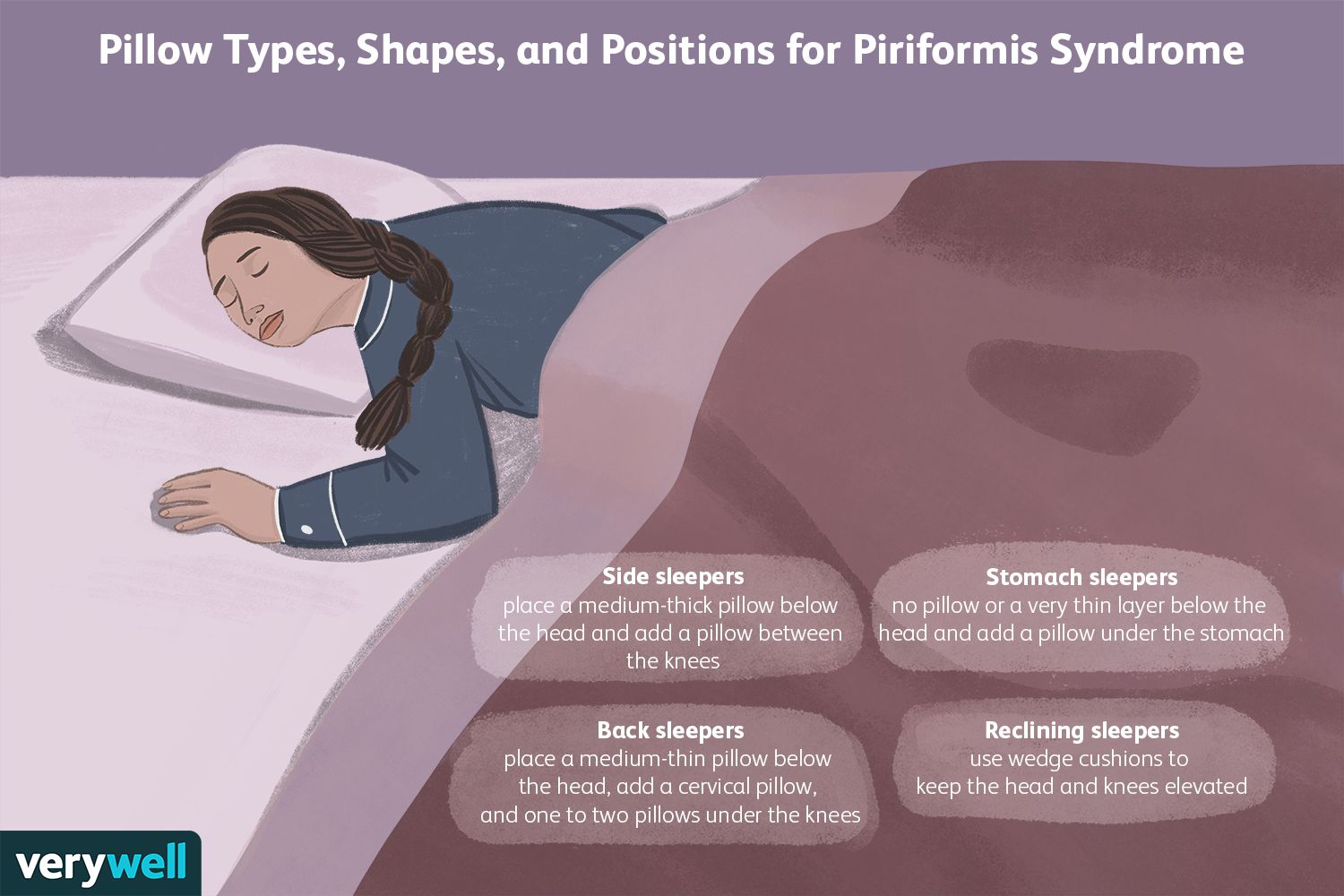 how to sleep with piriformis syndrome?