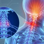 Can A Pinched Nerve In The Neck Cause Head Pain